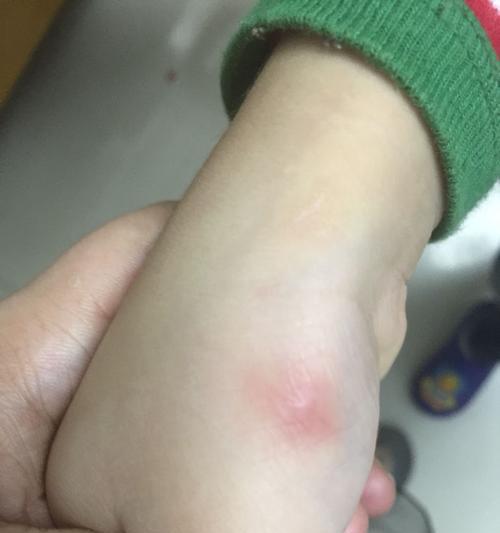 猫猫弓虫病（预防和治疗猫猫弓虫病的重要知识，让你的猫咪远离健康威胁）