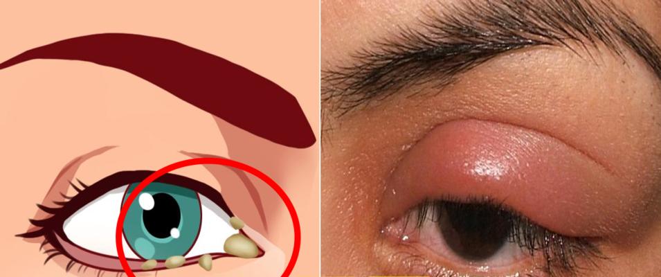 金毛为何总是生眼屎？（探究金毛生眼屎的原因与处理方法）