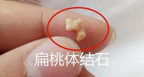 身上气味臭可能是什么病？（探索身体气味异常的潜在疾病及其治疗方法）