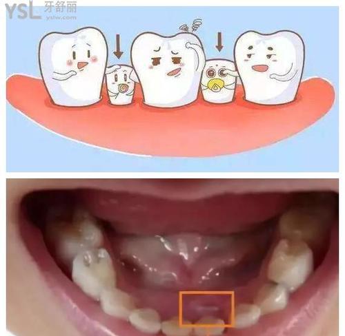 大牙的更替时机和保健方法（了解大牙更替的关键时期和正确的保健方法，保持口腔健康）