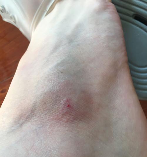 泰迪犬狂犬疫苗接种后的洗澡时间（疫苗注射后多久才能为你的泰迪犬洗澡？）