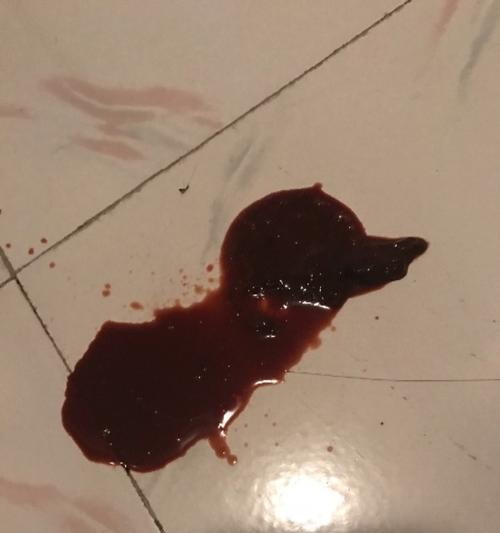 泰迪屎腥臭的原因解析（探究泰迪屎腥臭背后的科学原因）