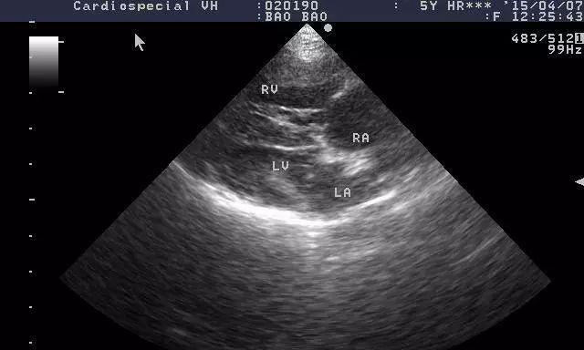 以犬得心丝虫病（揭秘以犬得心丝虫病）