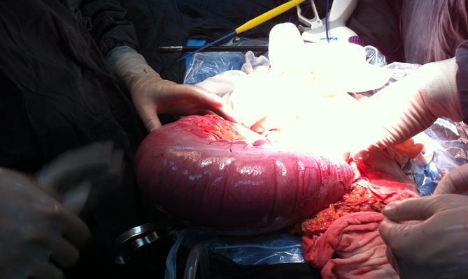 狗肠梗阻手术的恢复时间及注意事项（狗肠梗阻手术后需要多久恢复正常？如何加速康复？）